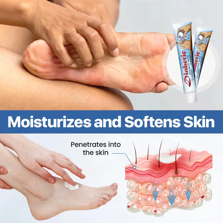 LIMITED TIME SALE OFF 60% 🔥AnnieCare® VitaGluco Diabetes Treatment Cream -👨‍⚕️ American Academy of Dermatology (AAD) Approved